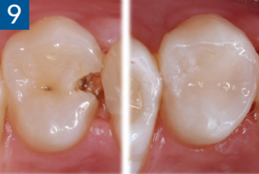 Figure 9