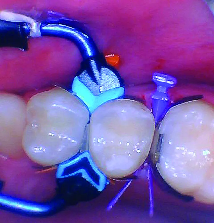 BurtonMatt_11_012025 Figure 11