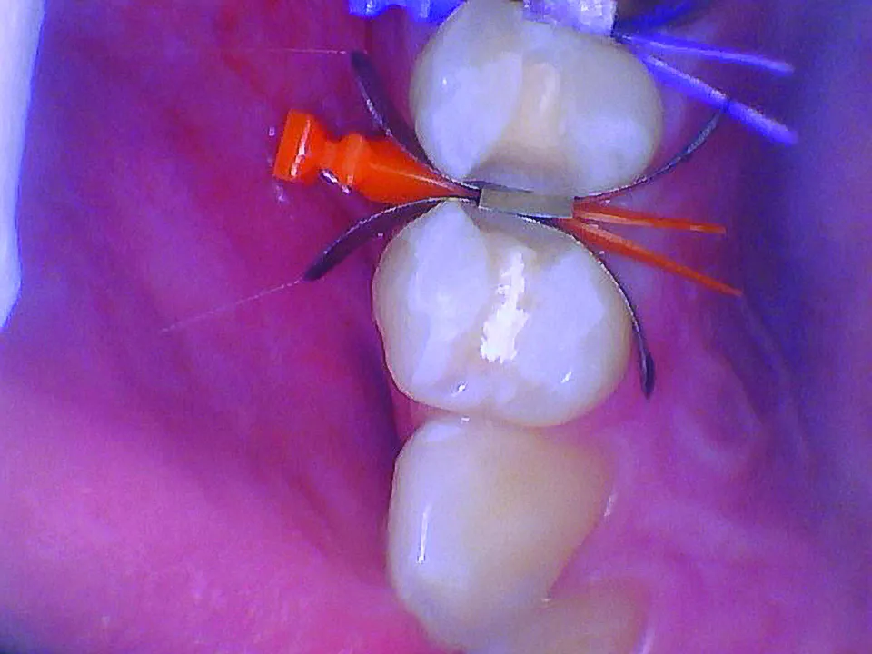 BurtonMatt_6_012025 Figure 6