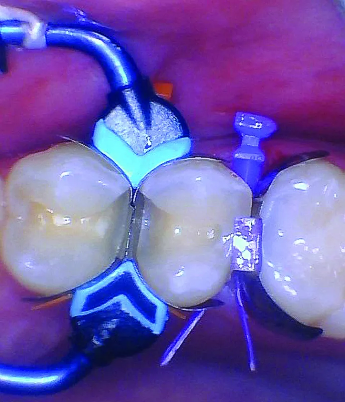 BurtonMatt_9_012025 Figure 9