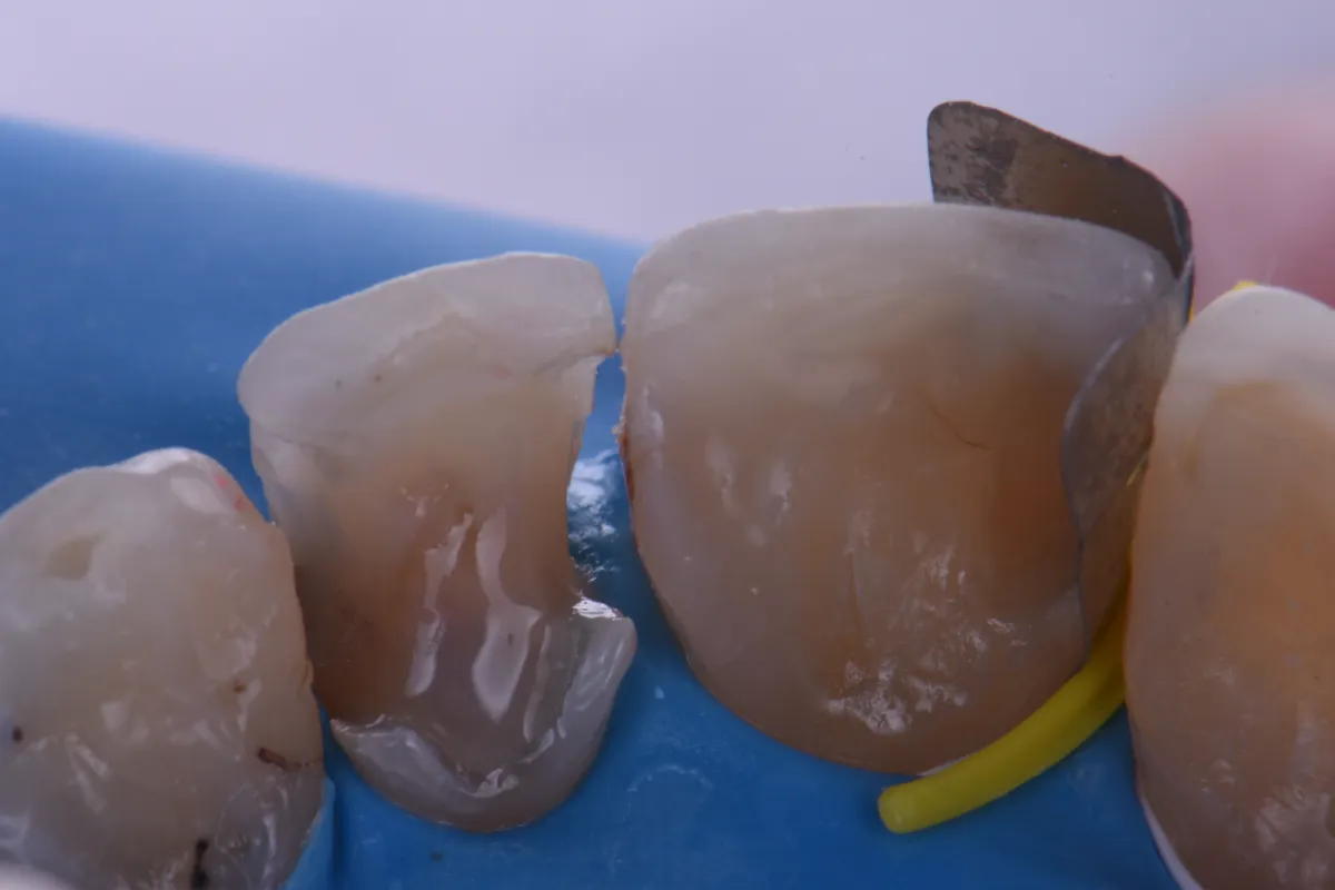 ClarenceTam_003_07132 Figure 3