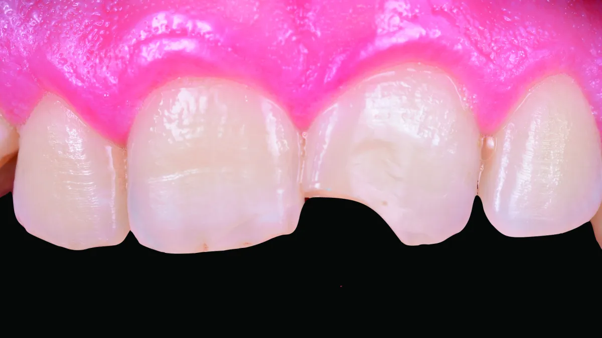 GianlucaRossi_001_040722 Figure 1