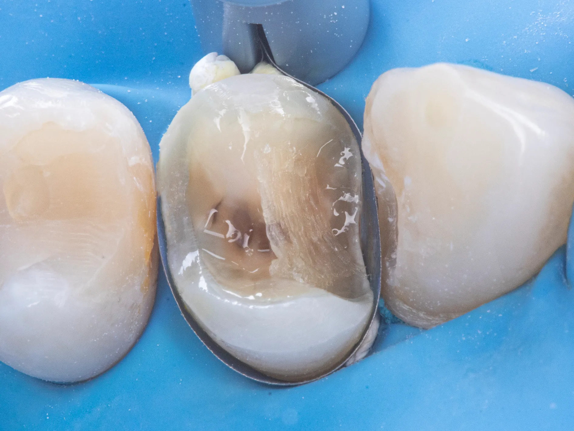 Dental CE Courses