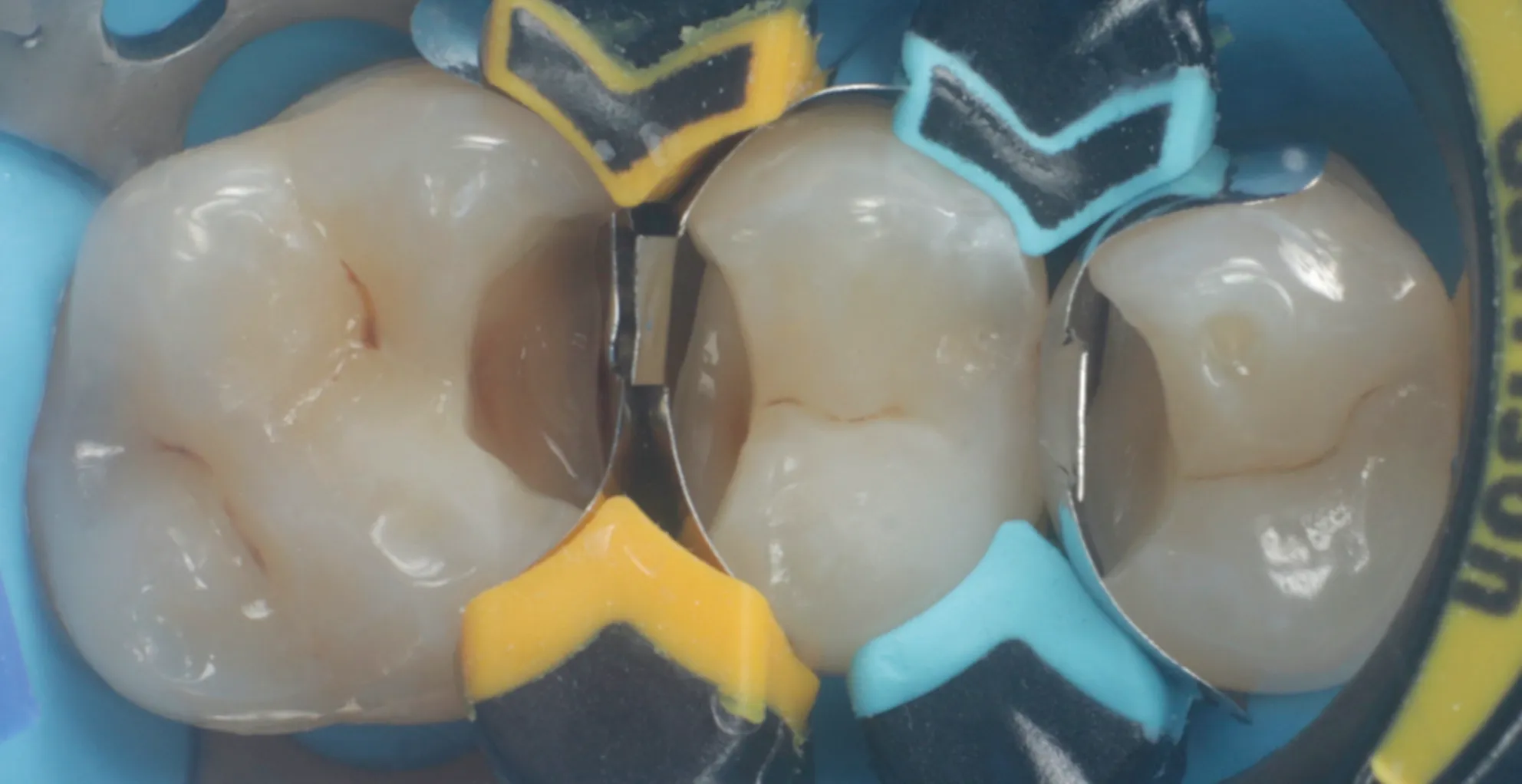 Dental CE Topic